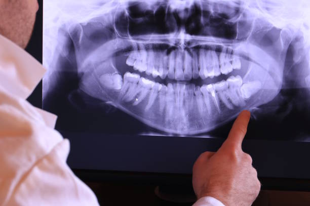 Best Pediatric Emergency Dentist in Aberdeen, OH