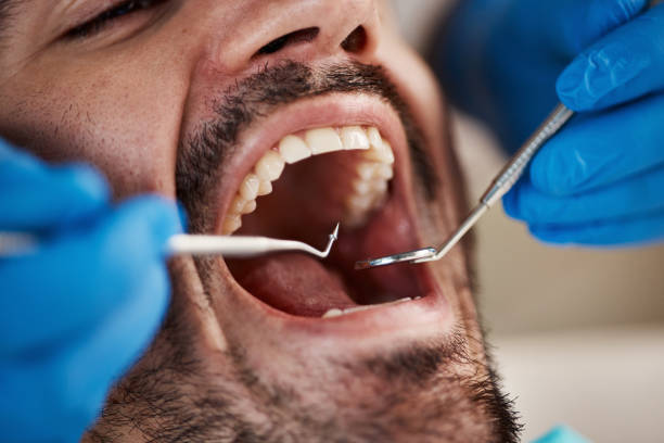 Best Weekend Emergency Dentist in Aberdeen, OH